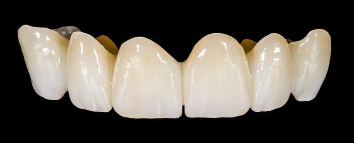 روکش زیرکونیوم دندان چه مزایا و کاربردهایی دارد؟