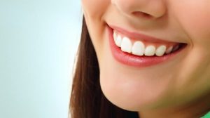 لمینت سرامیکی بدون تراش